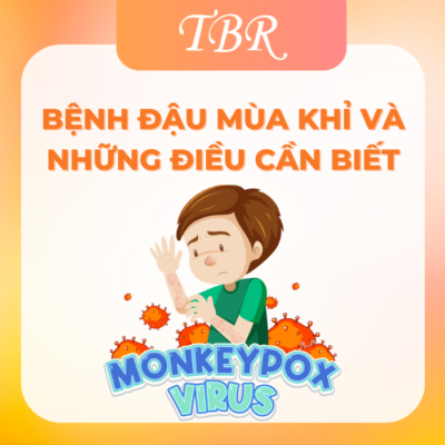 Bệnh đậu mùa khỉ và những điều cần biết