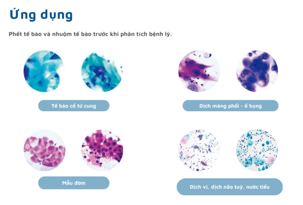 Ứng dụng của máy phết tế bào tự động
